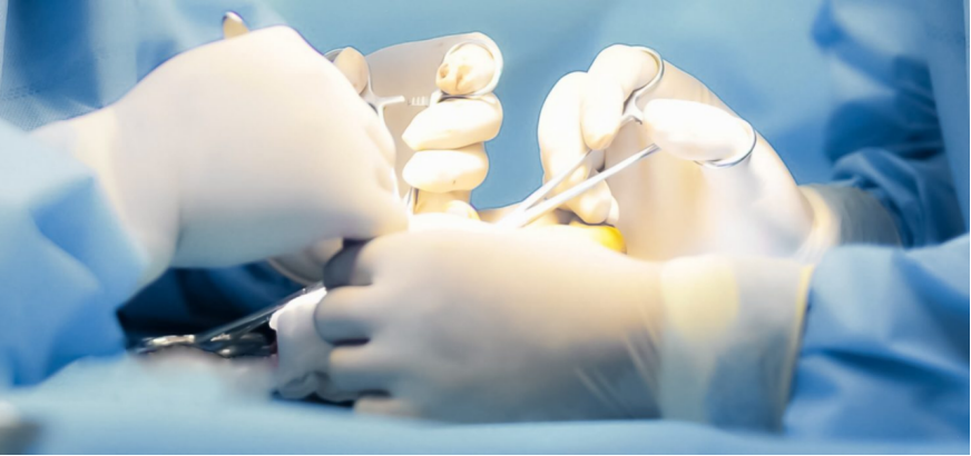 Surgical Gloves1