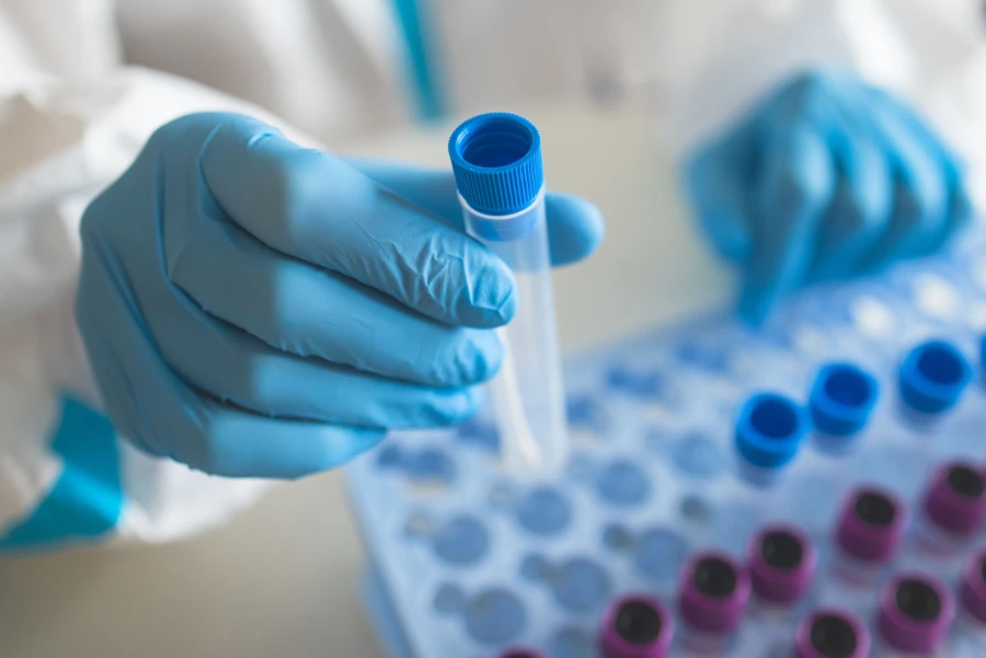 Lab testing with Nitrile Gloves