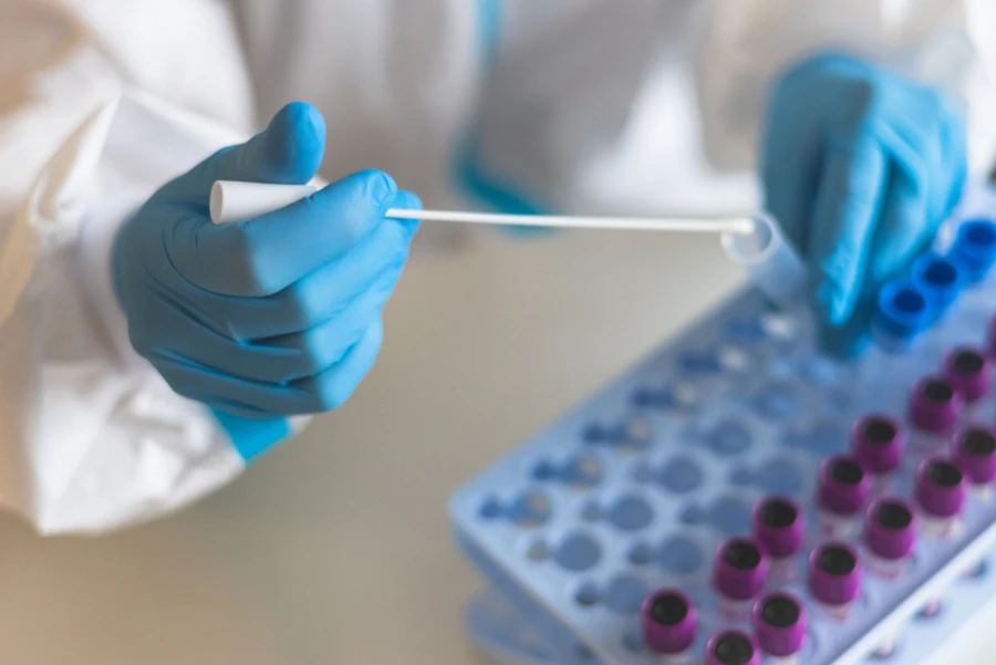 Disposable medical gloves used for precise sample handling in laboratory settings.