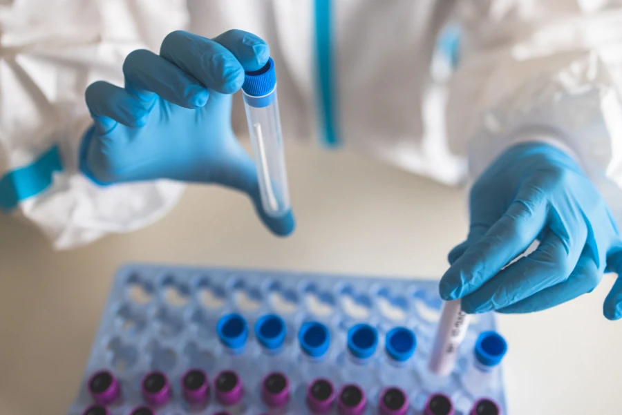 Lab testing with Nitrile Gloves